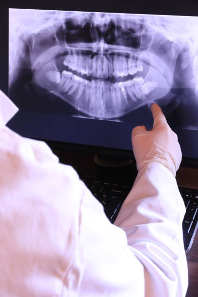 Best Emergency Wisdom Teeth Removal in Burbank, IL